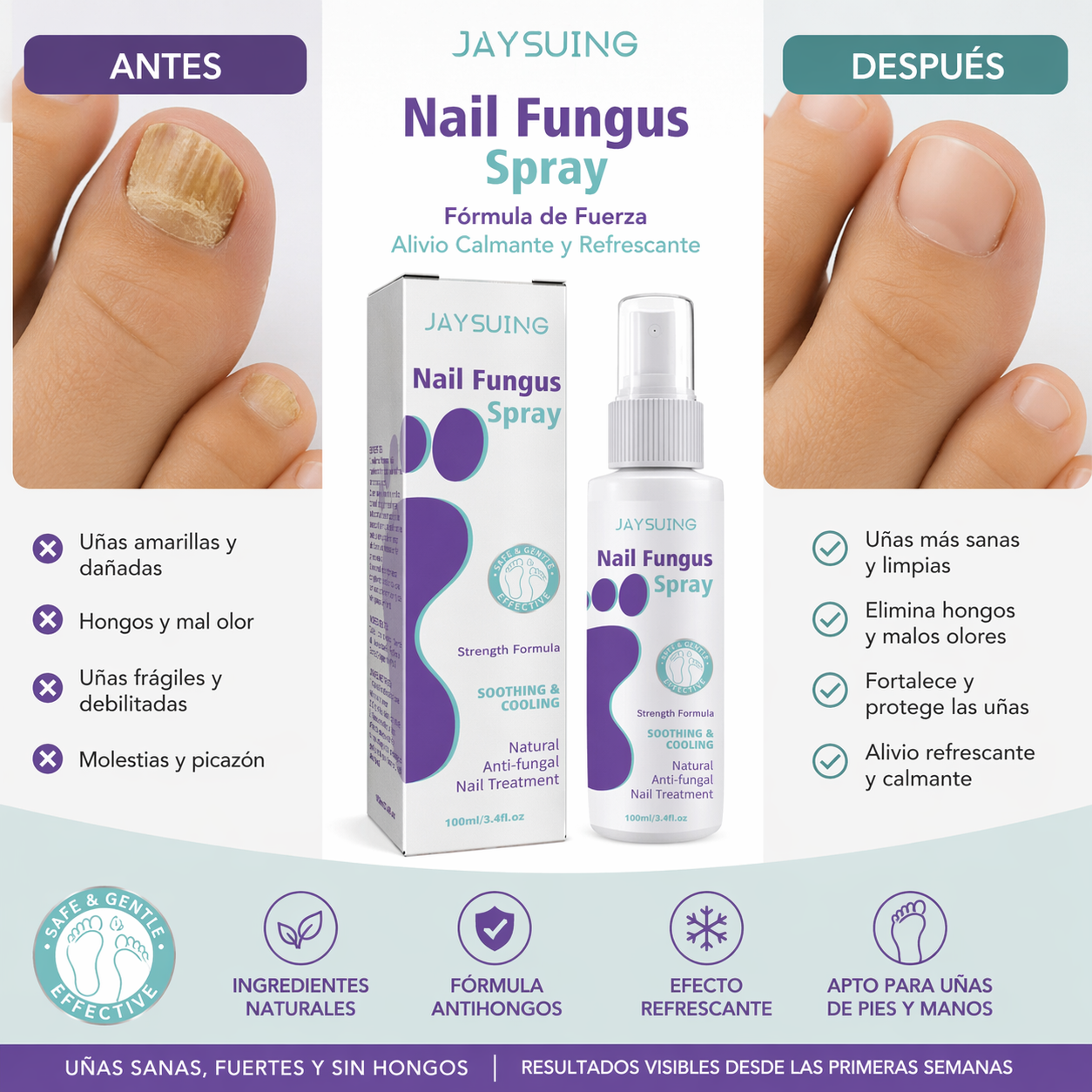 NAIL FUNGUS SPRAY